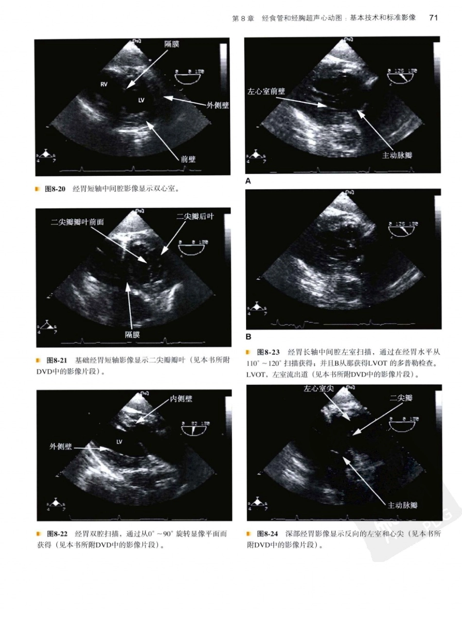 B超麻醉超声11-0_81-120.pdf_第2页