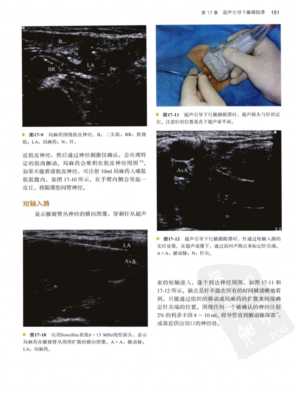B超麻醉超声11-0_161-200.pdf_第2页