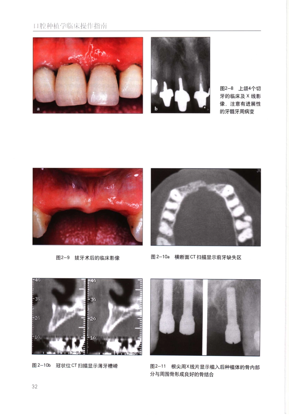 国际牙科名著系列-口腔种植学临床操作指南_严宁 译 _41-80.pdf_第1页