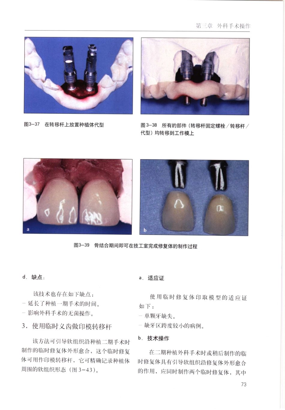 国际牙科名著系列-口腔种植学临床操作指南_严宁 译 _81-120.pdf_第2页