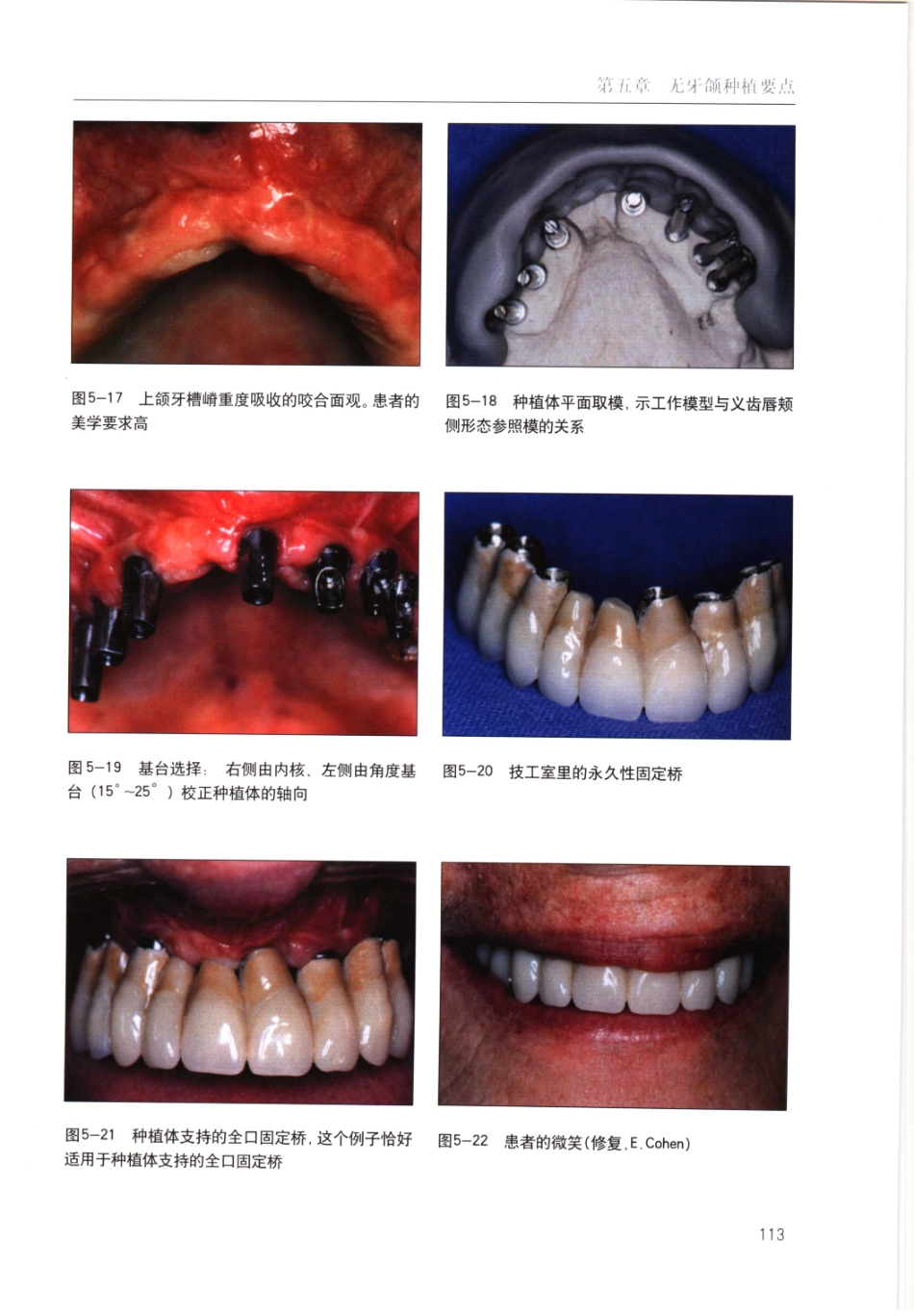 国际牙科名著系列-口腔种植学临床操作指南_严宁 译 _121-160.pdf_第2页