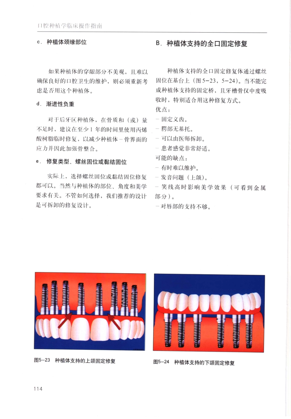 国际牙科名著系列-口腔种植学临床操作指南_严宁 译 _121-160.pdf_第3页