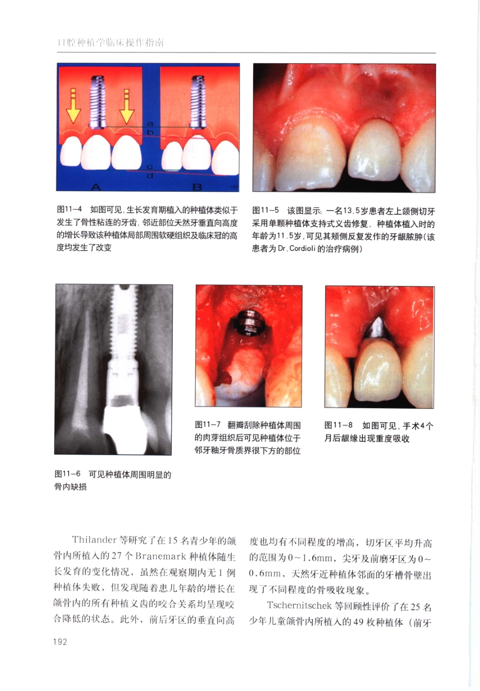 国际牙科名著系列-口腔种植学临床操作指南_严宁 译 _201-217.pdf_第1页