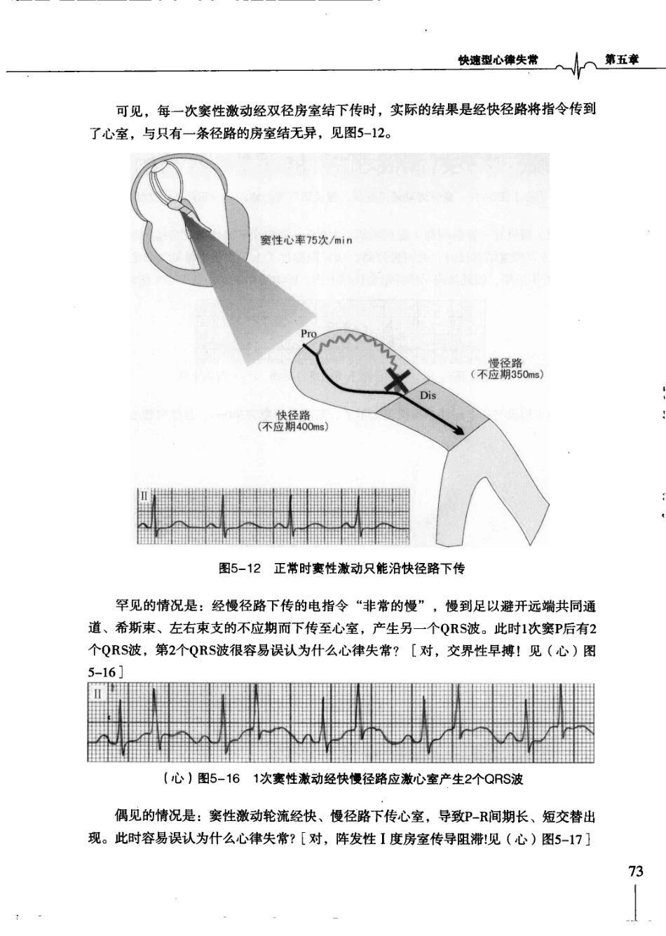 明明白白心电图(第3版).柳竣.王莺_81-120.pdf_第3页