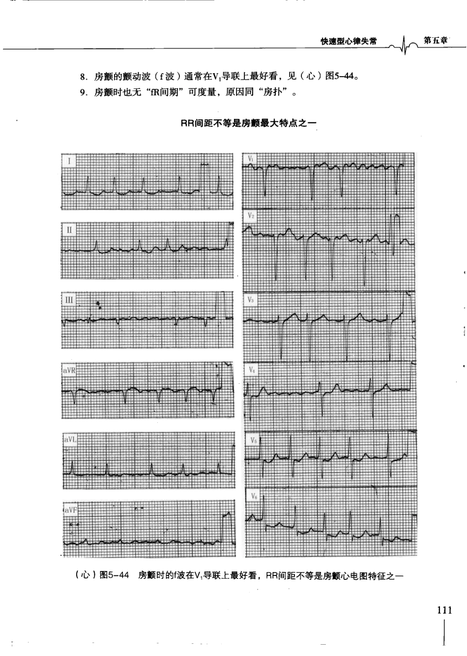 明明白白心电图(第3版).柳竣.王莺_121-160.pdf_第1页