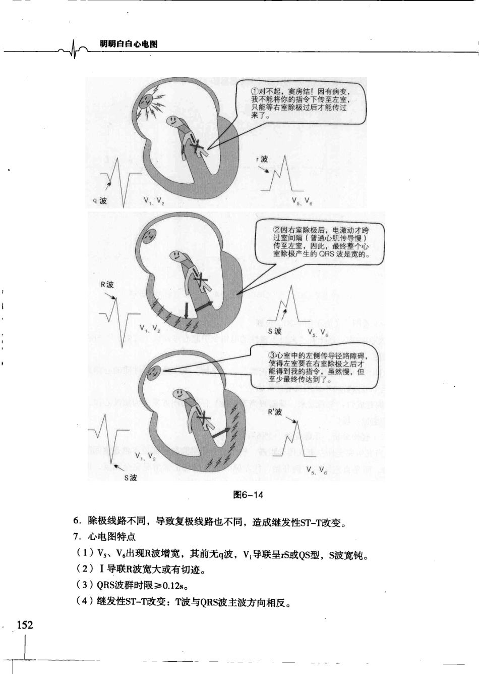 明明白白心电图(第3版).柳竣.王莺_161-200.pdf_第2页