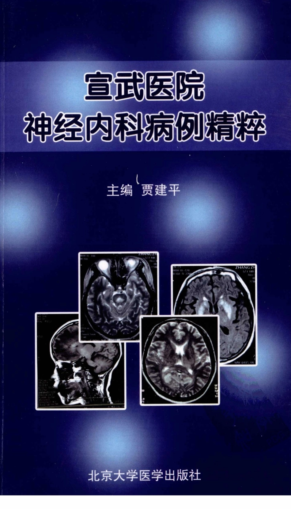 宣武医院神经内科病例精粹_12438859_1-60.pdf_第1页