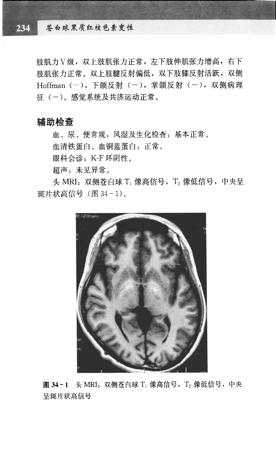 宣武医院神经内科病例精粹_12438859_241-300.pdf_第1页