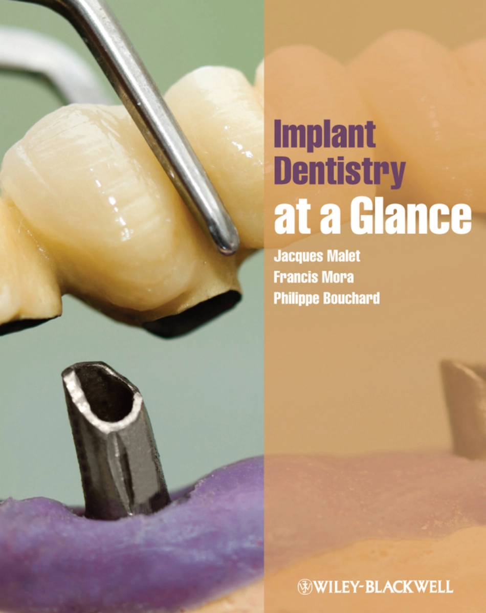 种植Implant Dentistry at a Glance（2012）_1-30.pdf_第1页