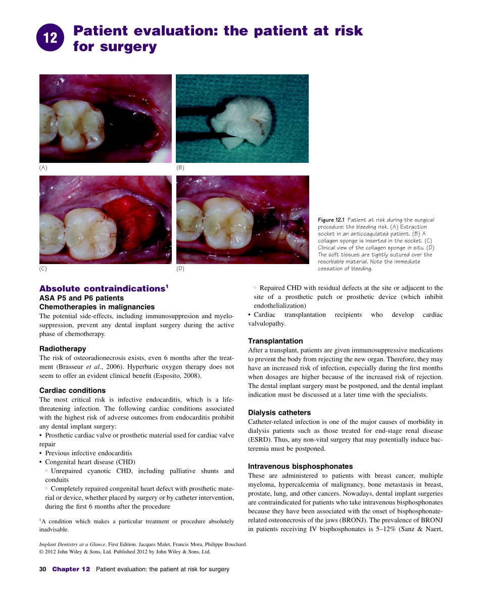 种植Implant Dentistry at a Glance（2012）_31-60.pdf_第2页