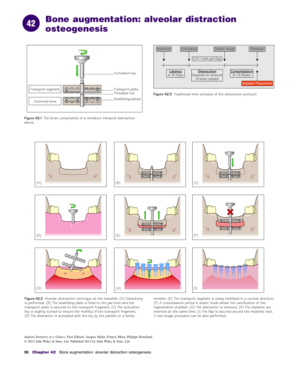 种植Implant Dentistry at a Glance（2012）_91-120.pdf_第2页