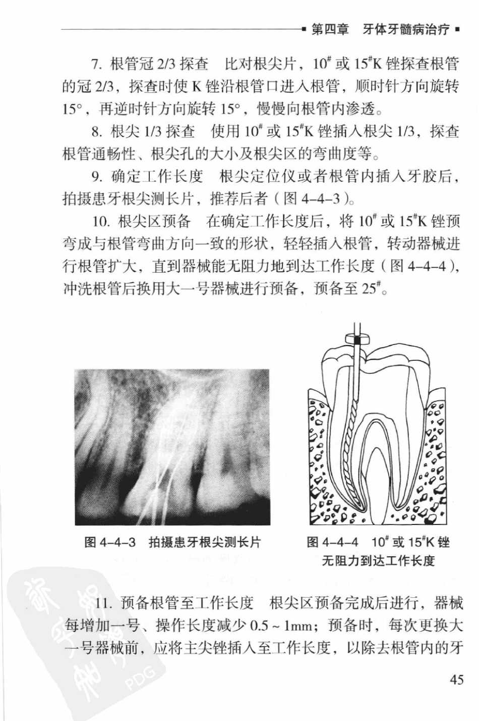 口腔全科医师临床操作手册_（2012年9月）_51-100.pdf_第3页