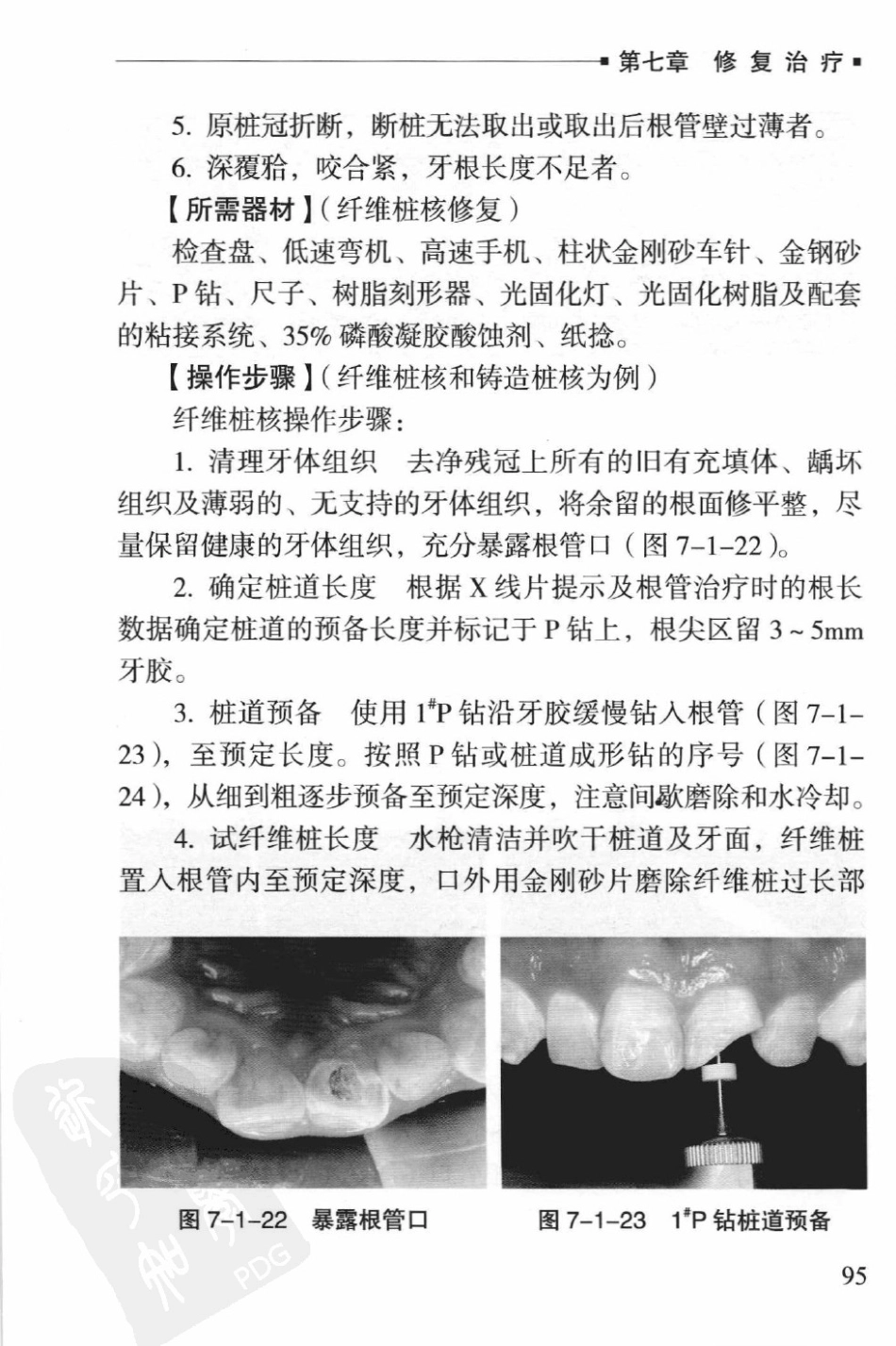 口腔全科医师临床操作手册_（2012年9月）_101-150.pdf_第3页