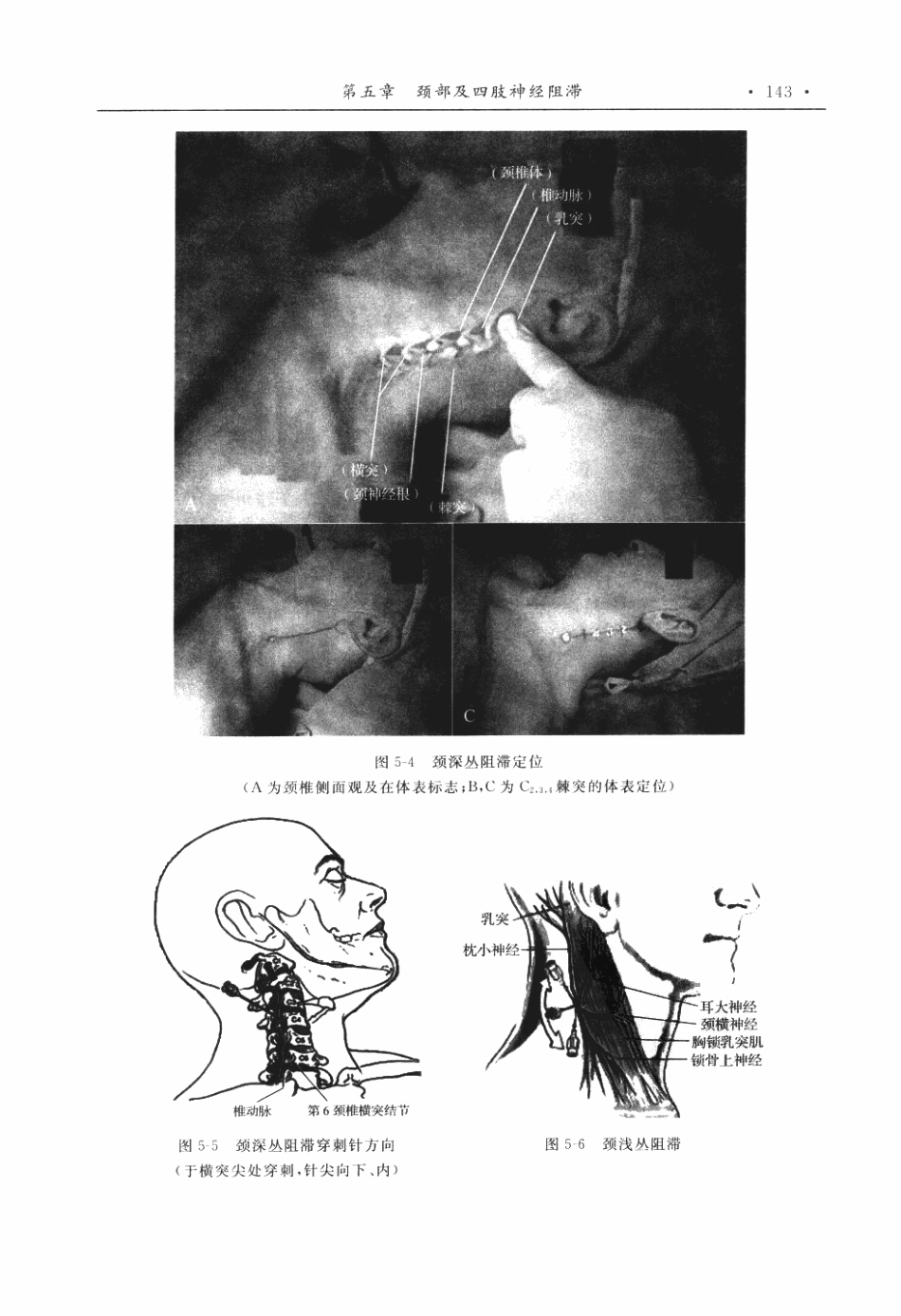 临床麻醉和疼痛治疗解剖学P_151-200.pdf_第2页