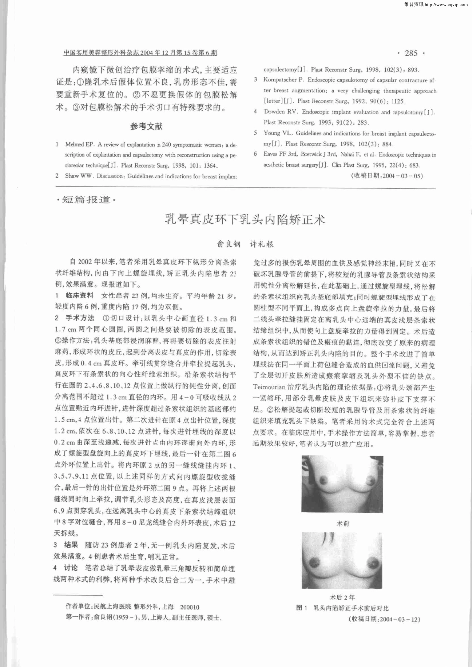 乳晕真皮环下乳头内陷矫正术.pdf_第1页