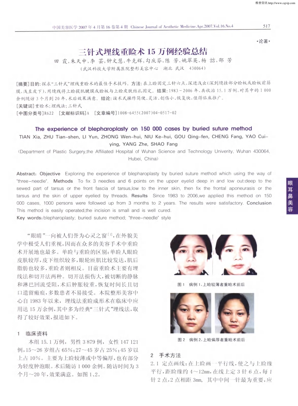 三针式埋线重睑术15万例经验总结.pdf_第1页