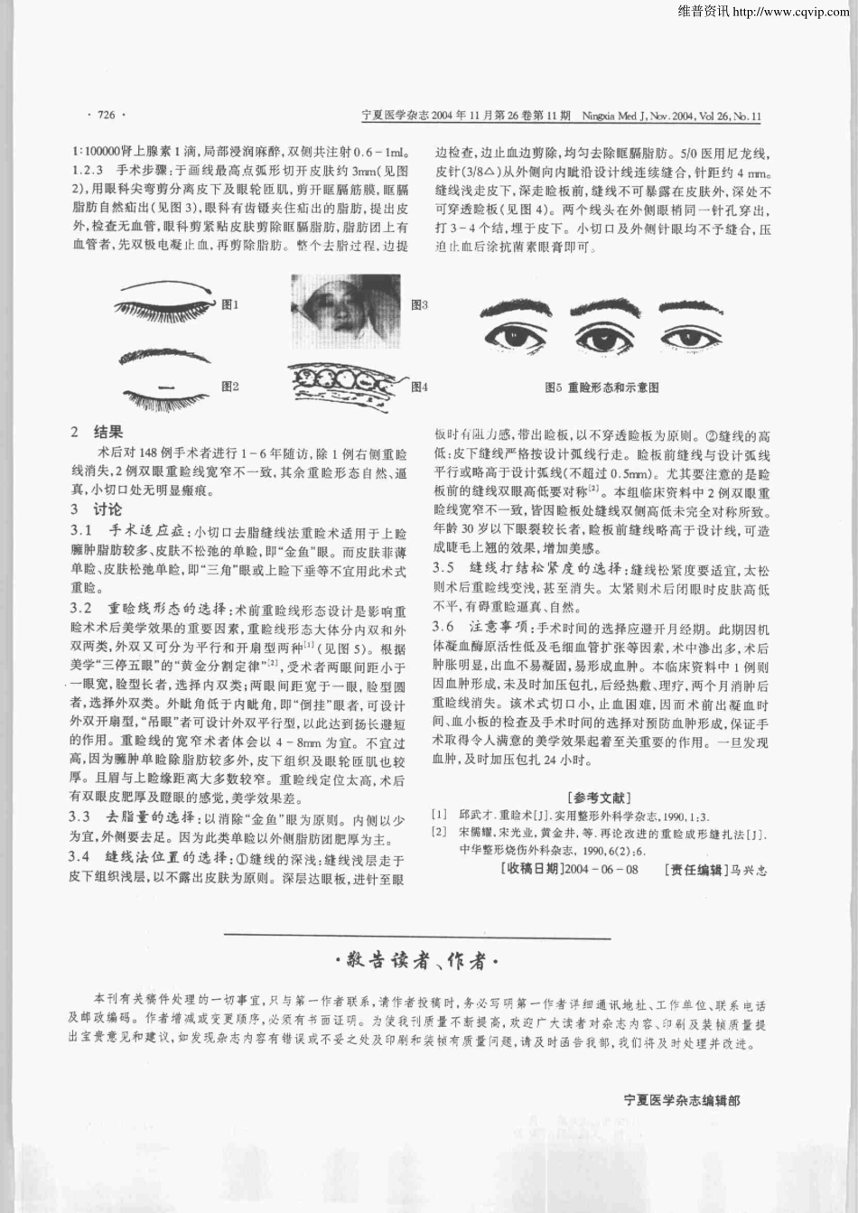 小切口去脂后埋线法重睑术420例临床分析.pdf_第2页