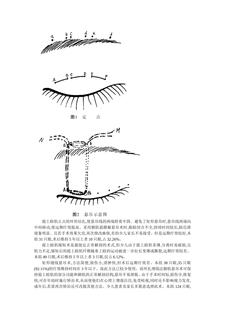 穴位埋线文档 (7).doc_第2页