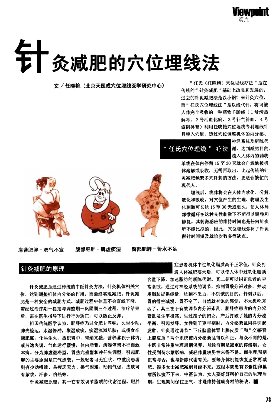 针灸减肥的穴位埋线法.pdf_第1页