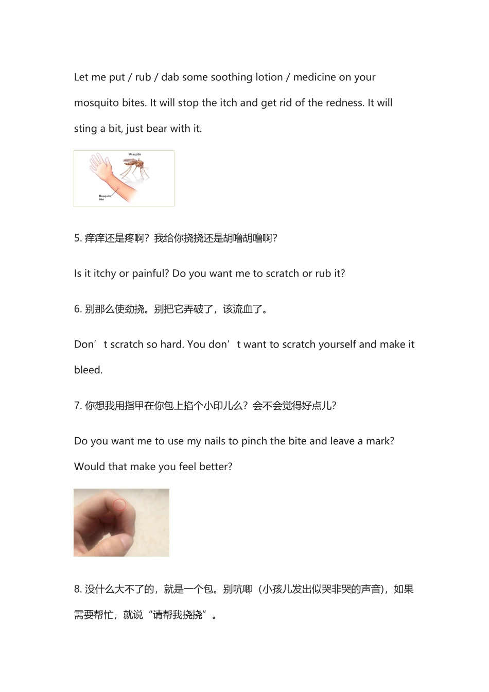 家里有蚊子和宝宝的,学学这些英文吧!痒vs疼,挠vs胡噜.docx_第3页
