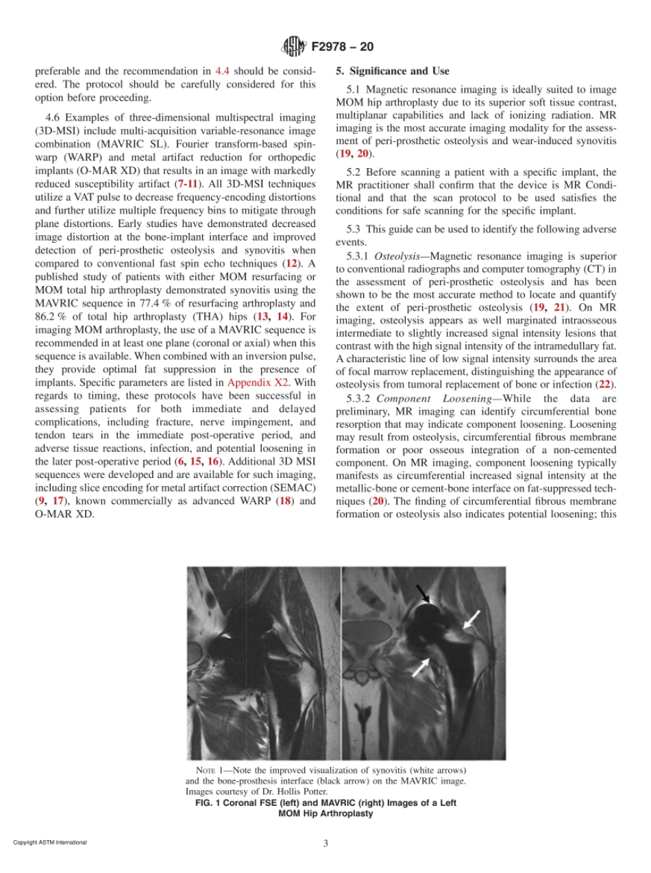 ASTM F2978-20 Standards Guide to Optimize Scan Sequences for Clinical Diagnostic.pdf_第3页