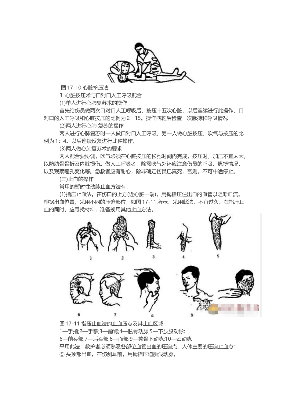 煤矿井下创伤急救基础知识.docx_第3页